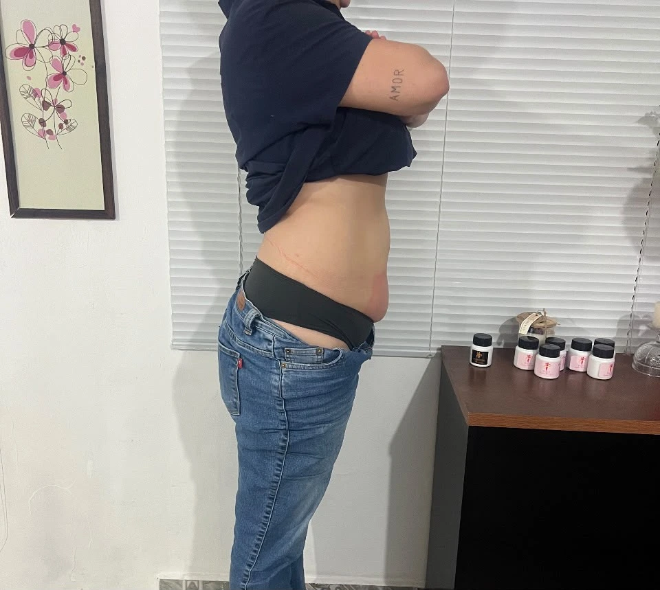 Resultado do Protocolo Sandra Domingues com redução de medidas e contorno definido