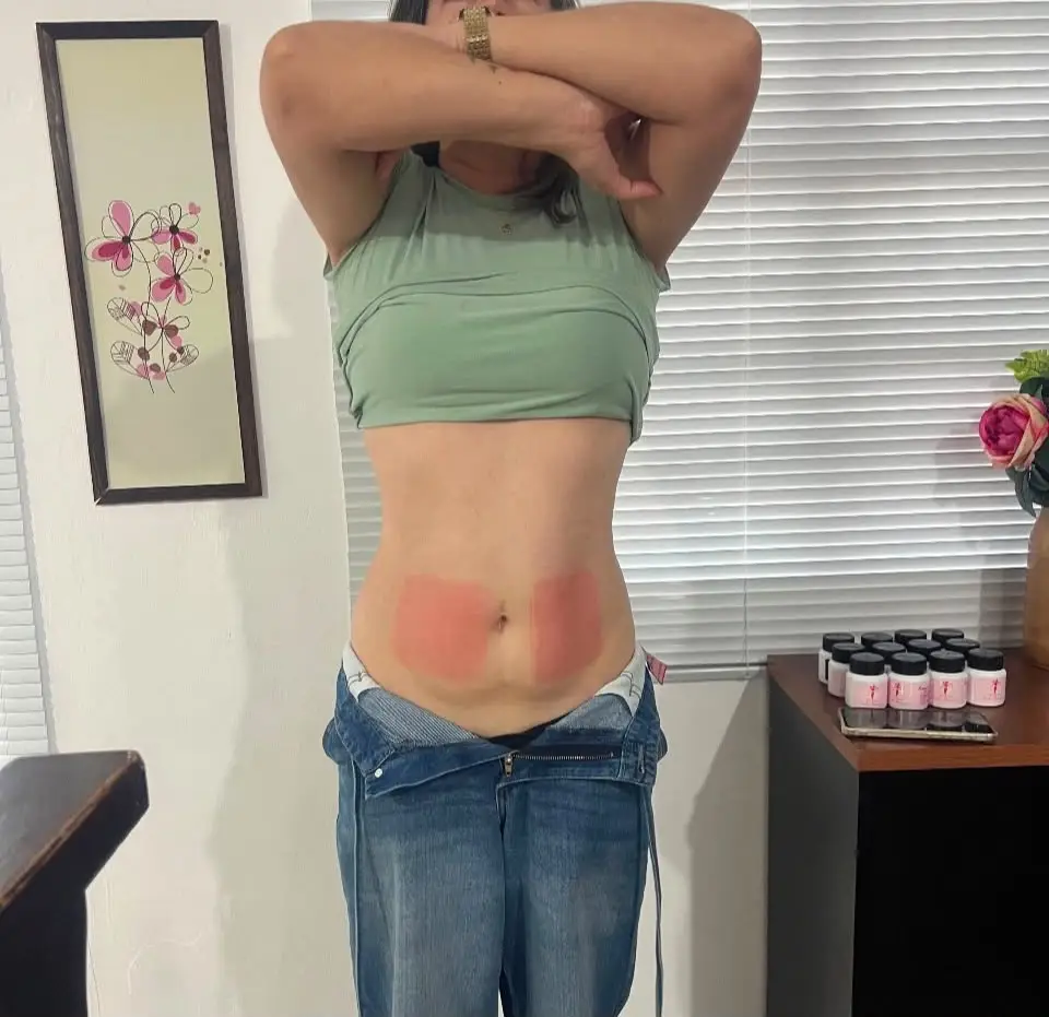 Resultado de contorno corporal após o tratamento